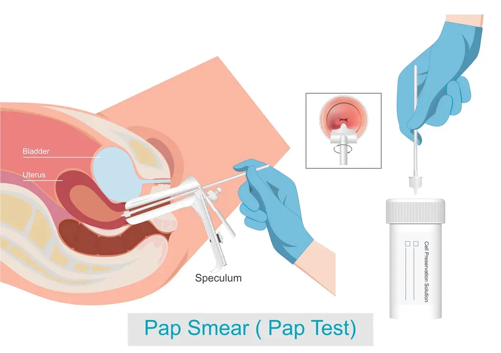 Abnormal Pap Smears for Cumming, GA | MAA Womens Health | OB-GYN