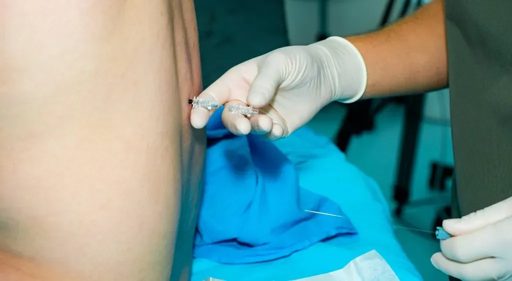 Everything You Need to Know About Nerve Blocks | Physician Assistant ...