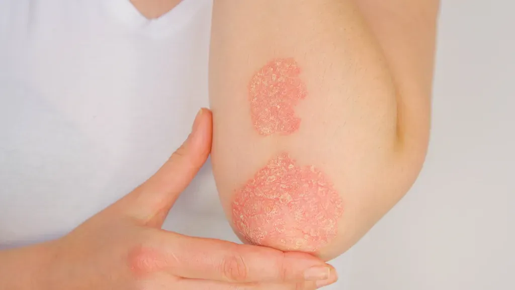 Shady Grove Dermatology | Dermatologists located in Rockville, MD