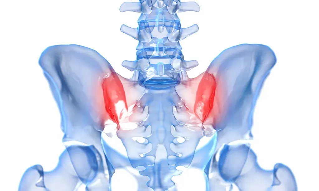 Sacroiliac Joint Injections for Clarkston, MI | Clarkston Pain and ...