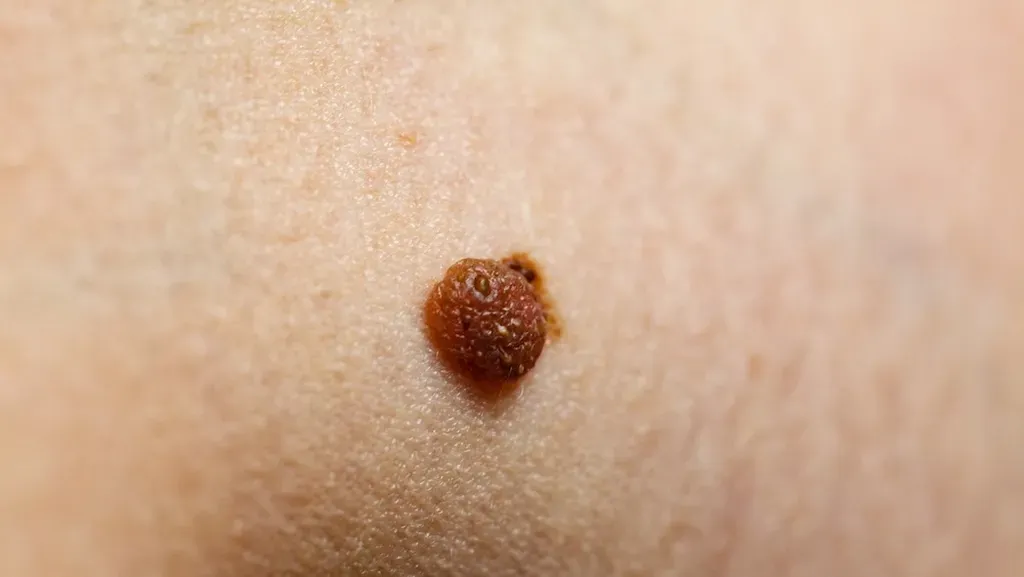 About Goodman Dermatology and Mohs Surgery | Board-Certified ...
