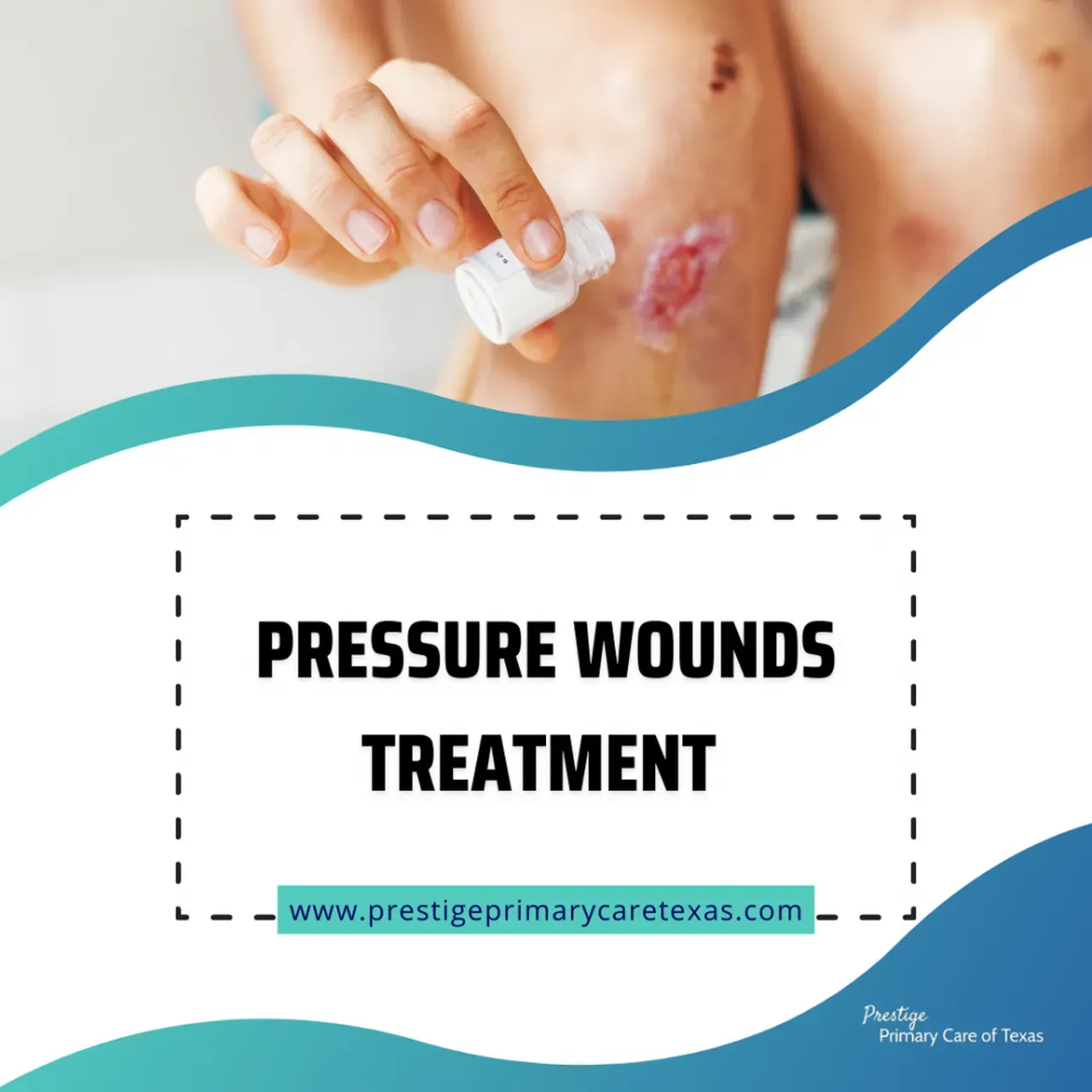 Pressure wound symptoms, treatment for pressure wounds – Akapv
