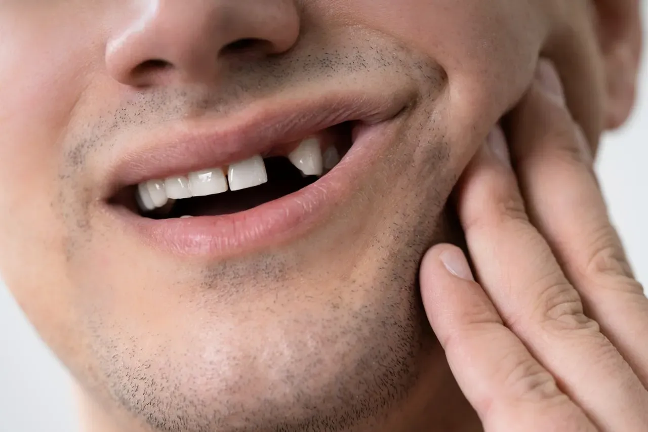 What to Do About a Cracked or Missing Tooth | General and Cosmetic ...