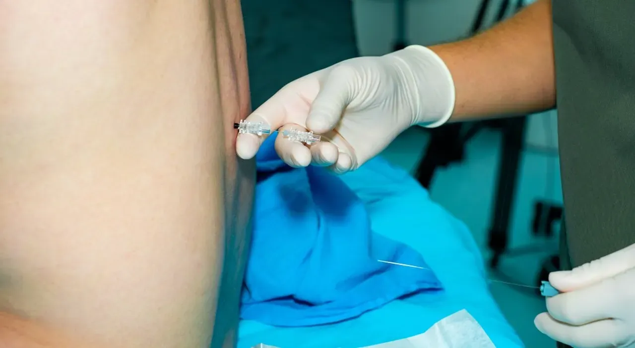 Everything You Need to Know About Nerve Blocks | Physician Assistant ...
