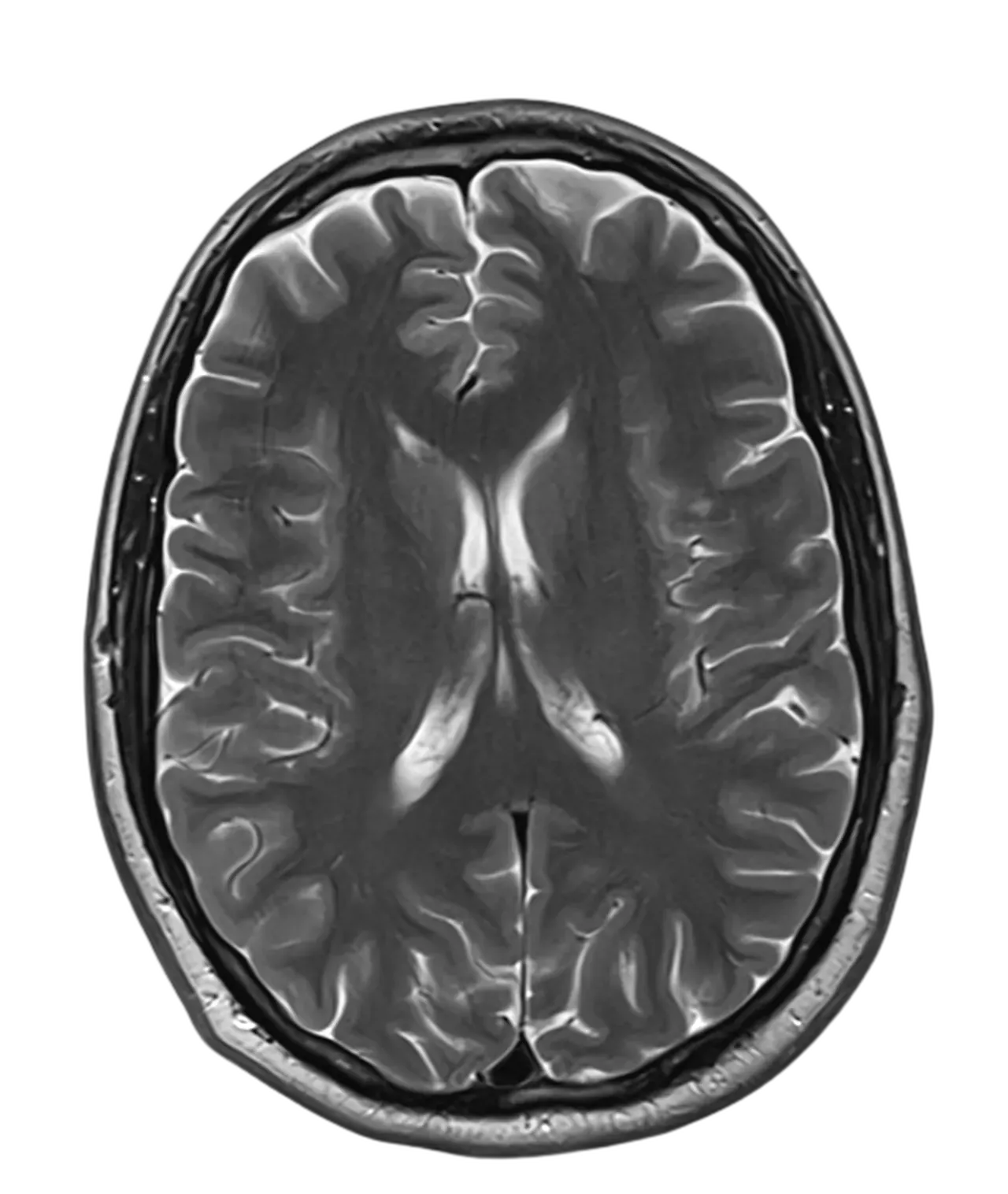 Smart Brain Scan - Santa Monica, CA & Beverly Hills, CA: Smart Brain ...
