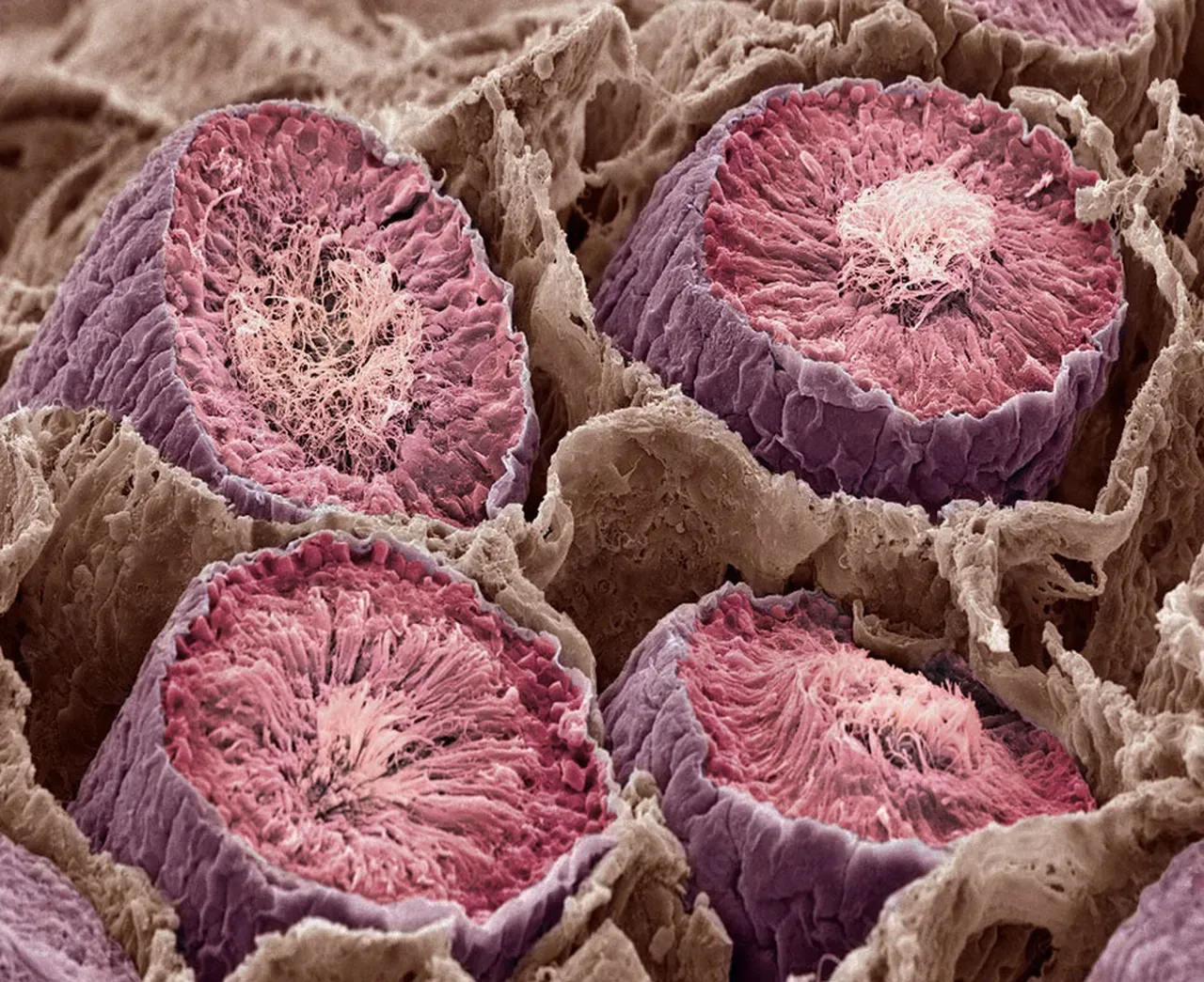 Understanding Testicular Sperm Extraction: TESE and microTESE ...