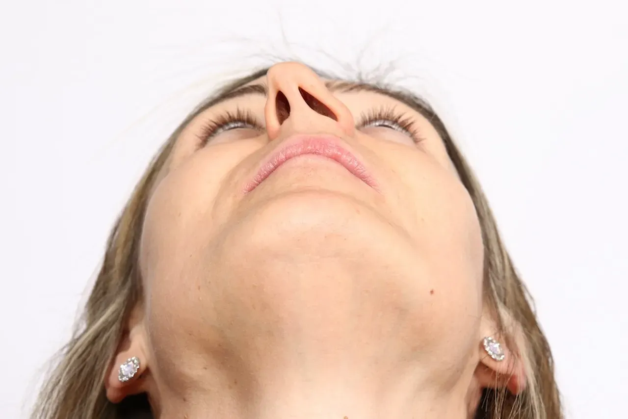 Deviated Septum for Lake Oswego, OR | Lake Grove ENT | Board Certified ...