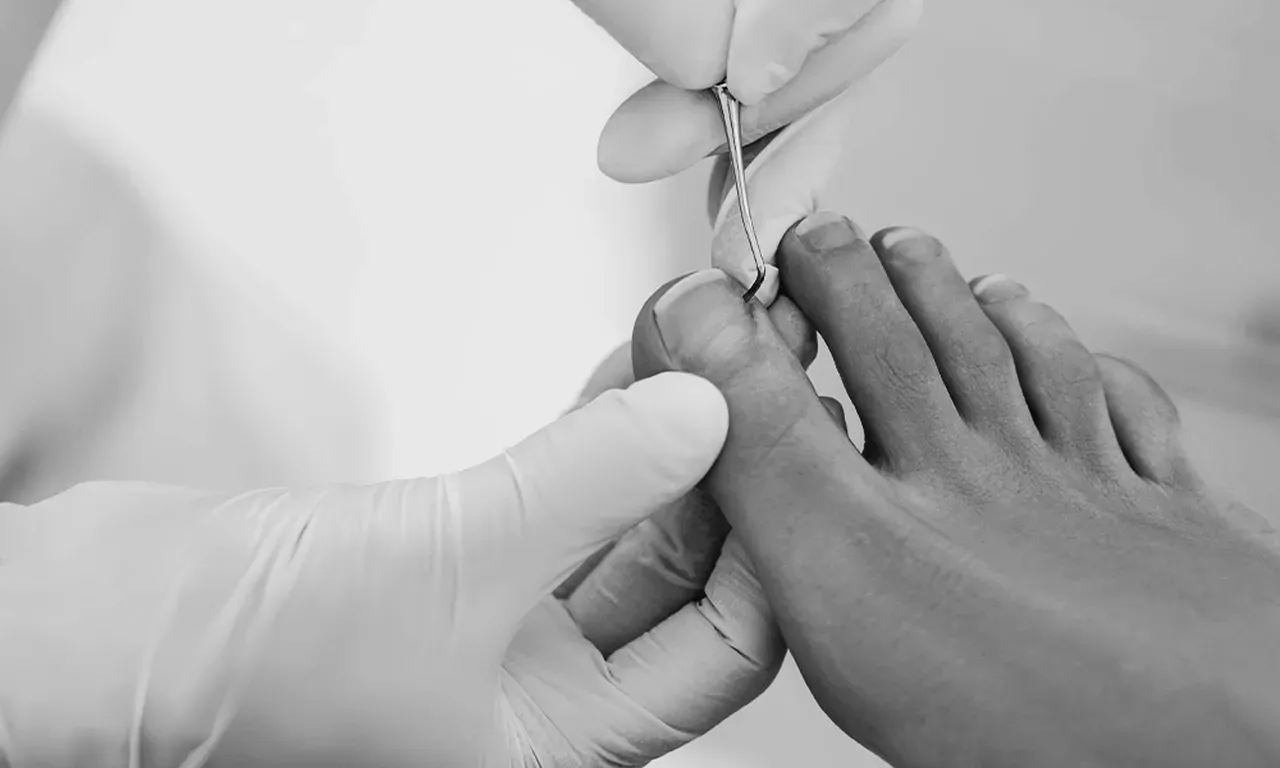 Step By Step Foot and Ankle Center | Podiatrist Foot & Ankle Surgeon ...