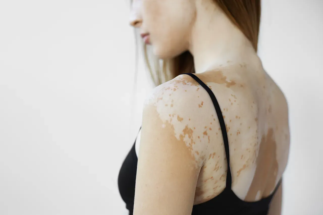 Dermatology Practice located in McKinleyville, Crescent City, and ...