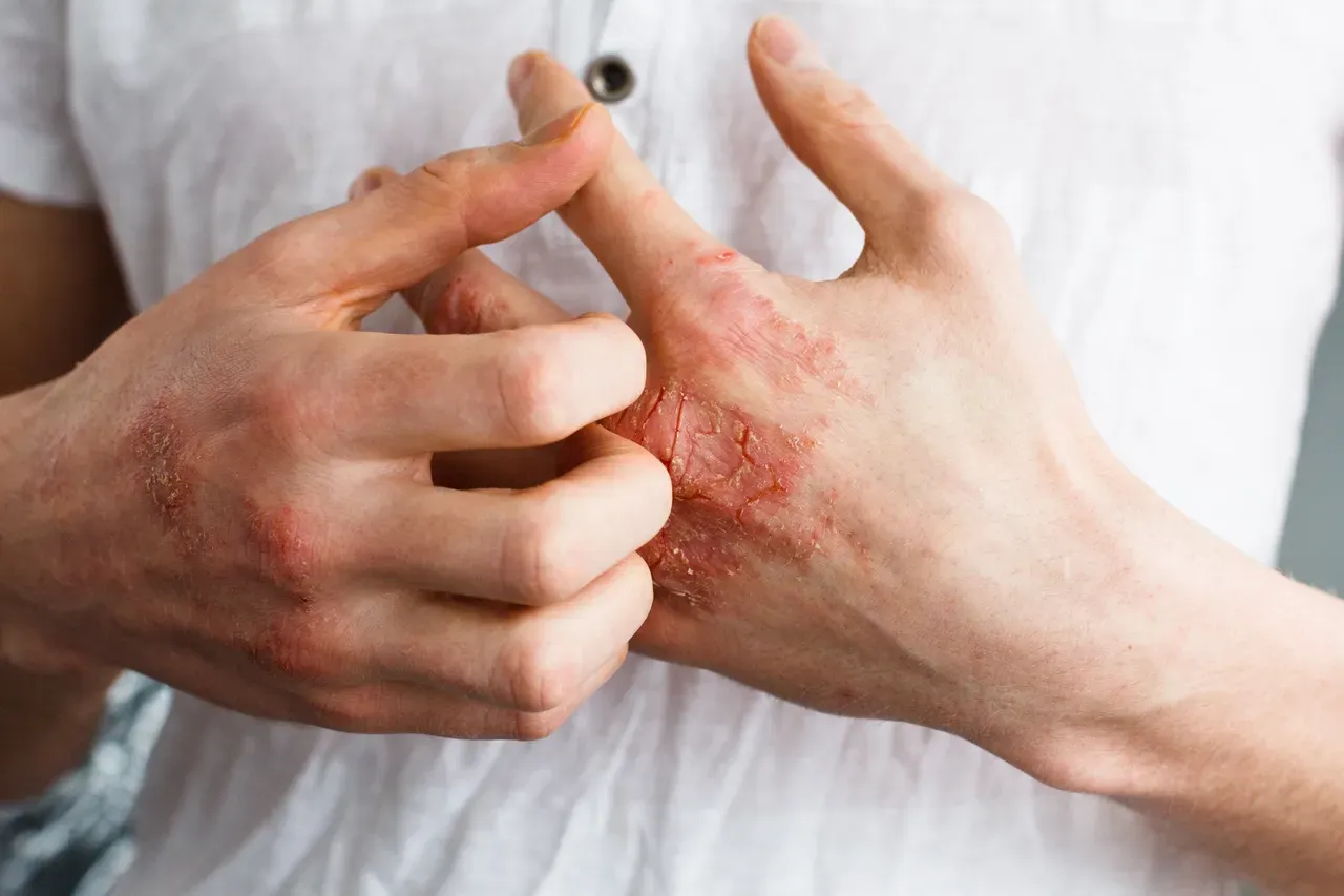 Shady Grove Dermatology | Dermatologists located in Rockville, MD
