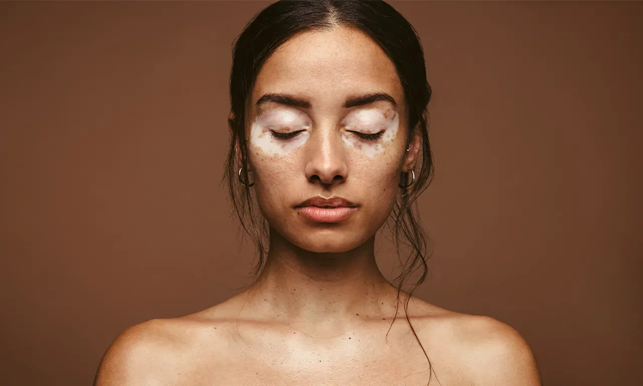 Skin Disorders for Miami, Homestead, Sarasota, Venice , Bradenton ...