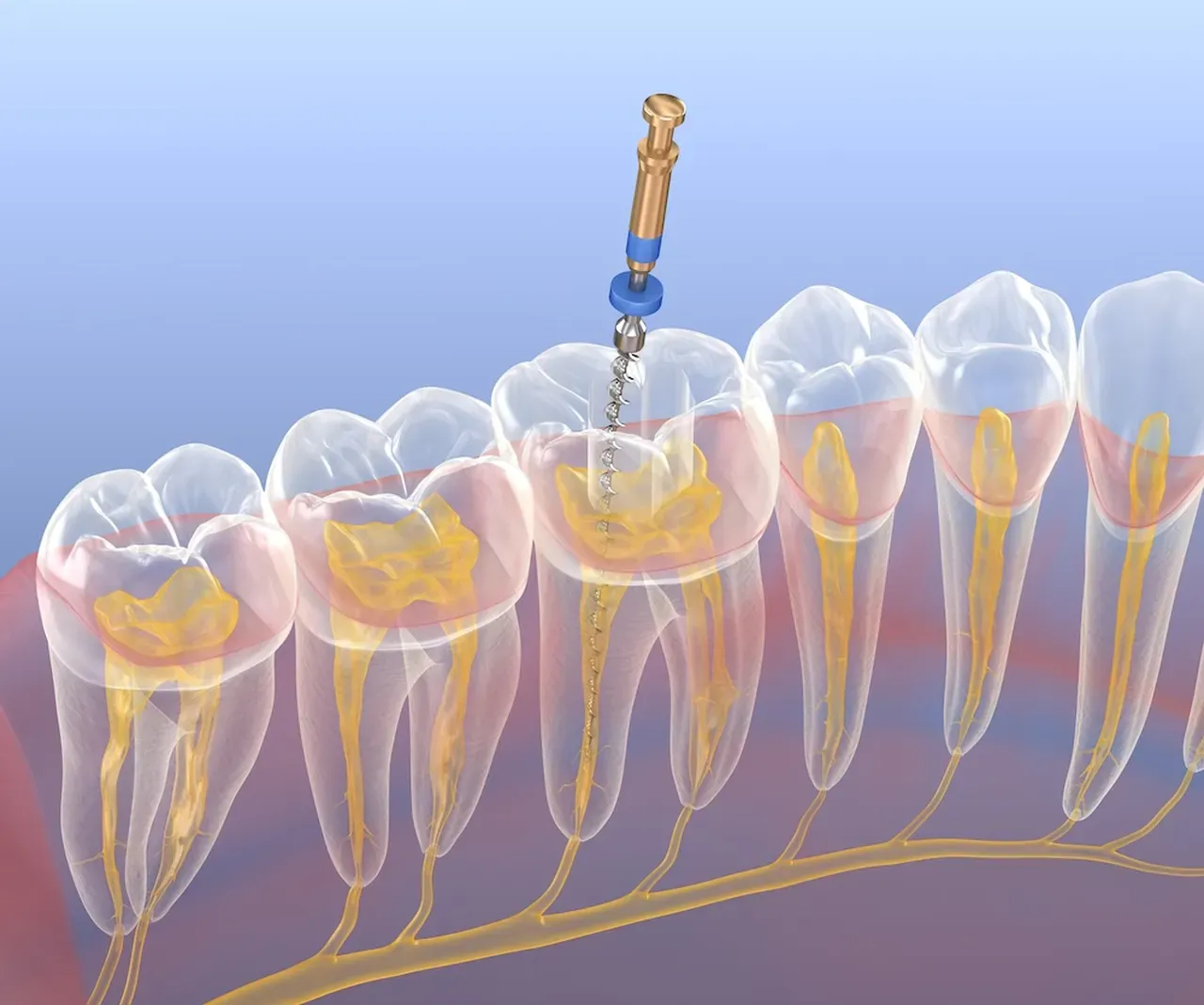 My Tooth Place | General and Cosmetic Dentistry & Periodontics located ...