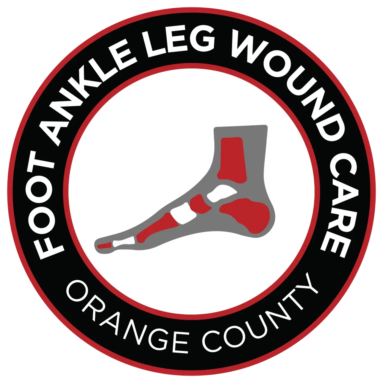 Swollen Leg for Mission Viejo, CA | Foot Ankle Leg Wound Care Orange ...