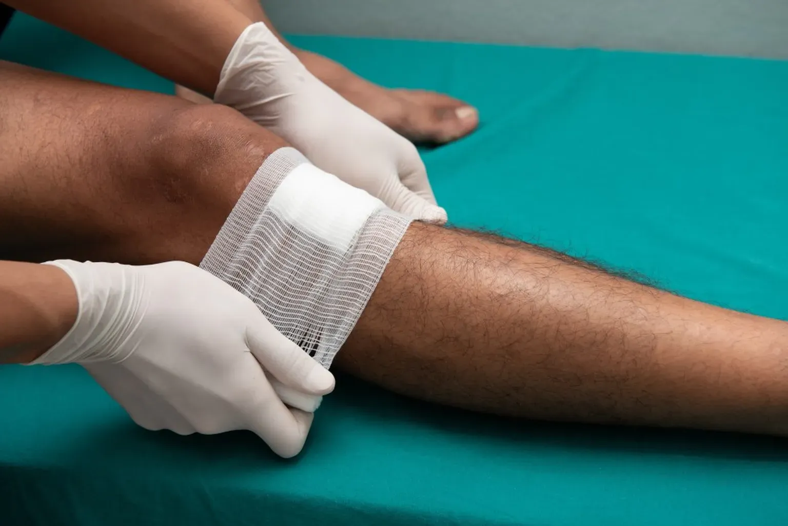 The 4 Stages of Wound Healing Explained | Wound Care located in Mission ...