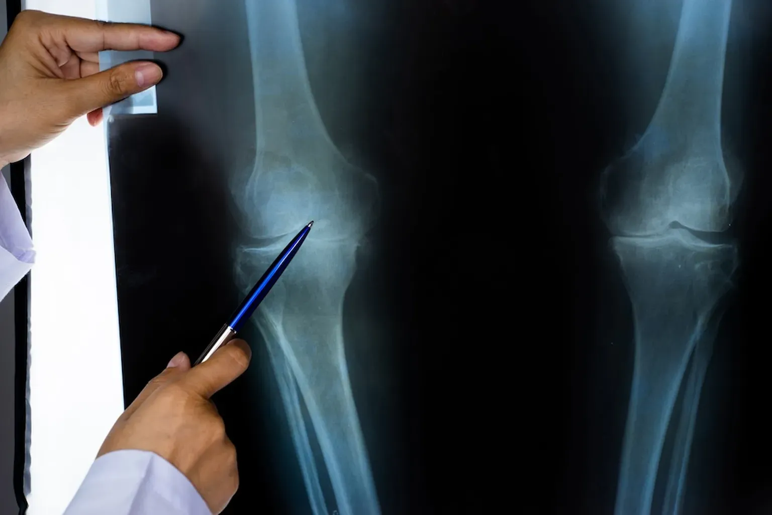 Rheumatology East | Rheumatology located in Germantown and Jackson, TN
