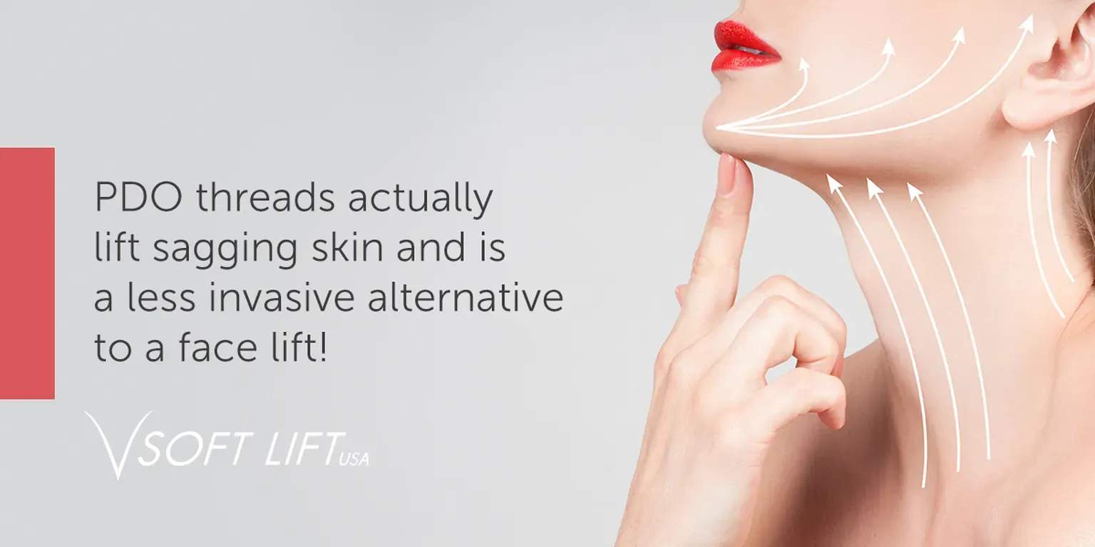 PDO Thread Lifts - Salem, VA & Adkins, TX: Starkey Medical Esthetics