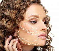 Thread Lifts