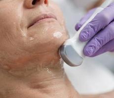 CryoTouch™ MD