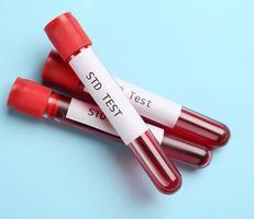 STD Testing