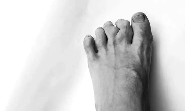 Step By Step Foot and Ankle Center | Podiatrist Foot & Ankle Surgeon ...
