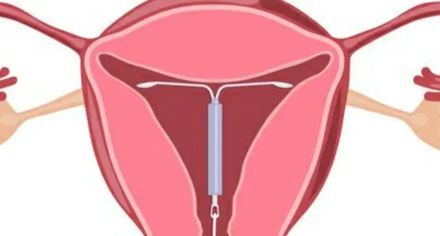Long-Term Birth Control Program - Phoenix, AZ: Desert Star Institute ...