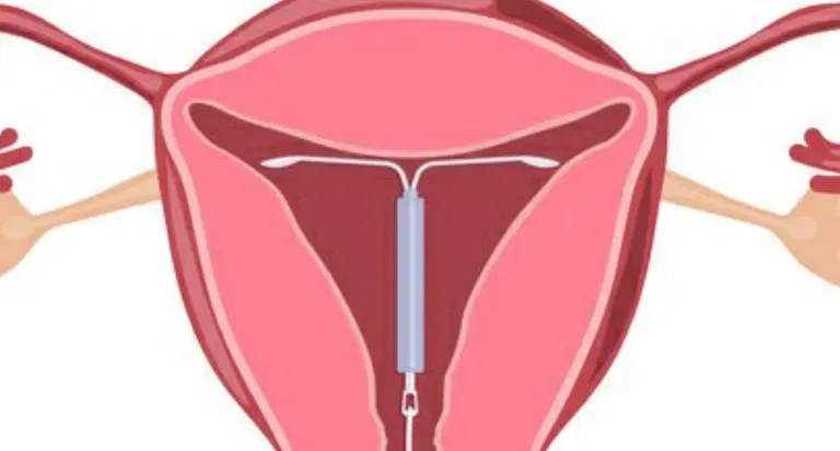 Long-Term Birth Control Program - Phoenix, AZ: Desert Star Institute ...