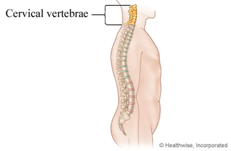Epidural Steroid Injections - Spring, TX & Liberty, TX: Advanced Spine ...