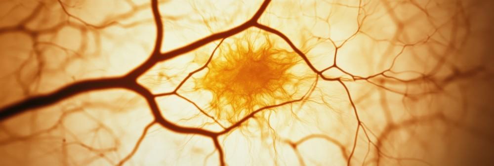  Macular Degeneration: What Slows It Down and What Speeds It Up