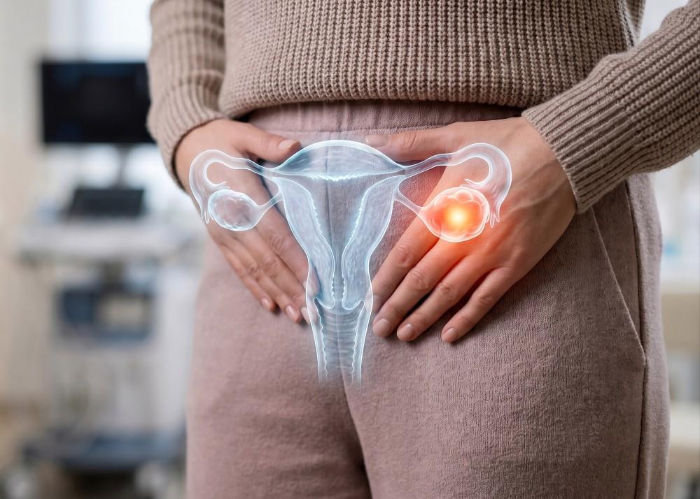Pelvic Pain? 5 Warning Signs You Might Have an Ovarian Cyst