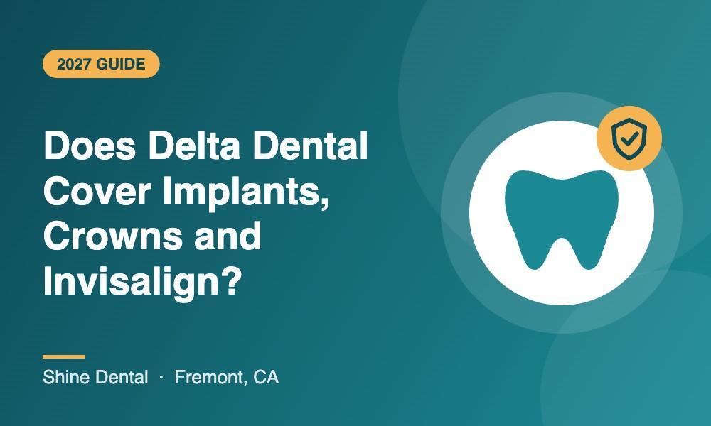 Shine Dental Fremont guide to Delta Dental PPO coverage for implants, crowns and Invisalign