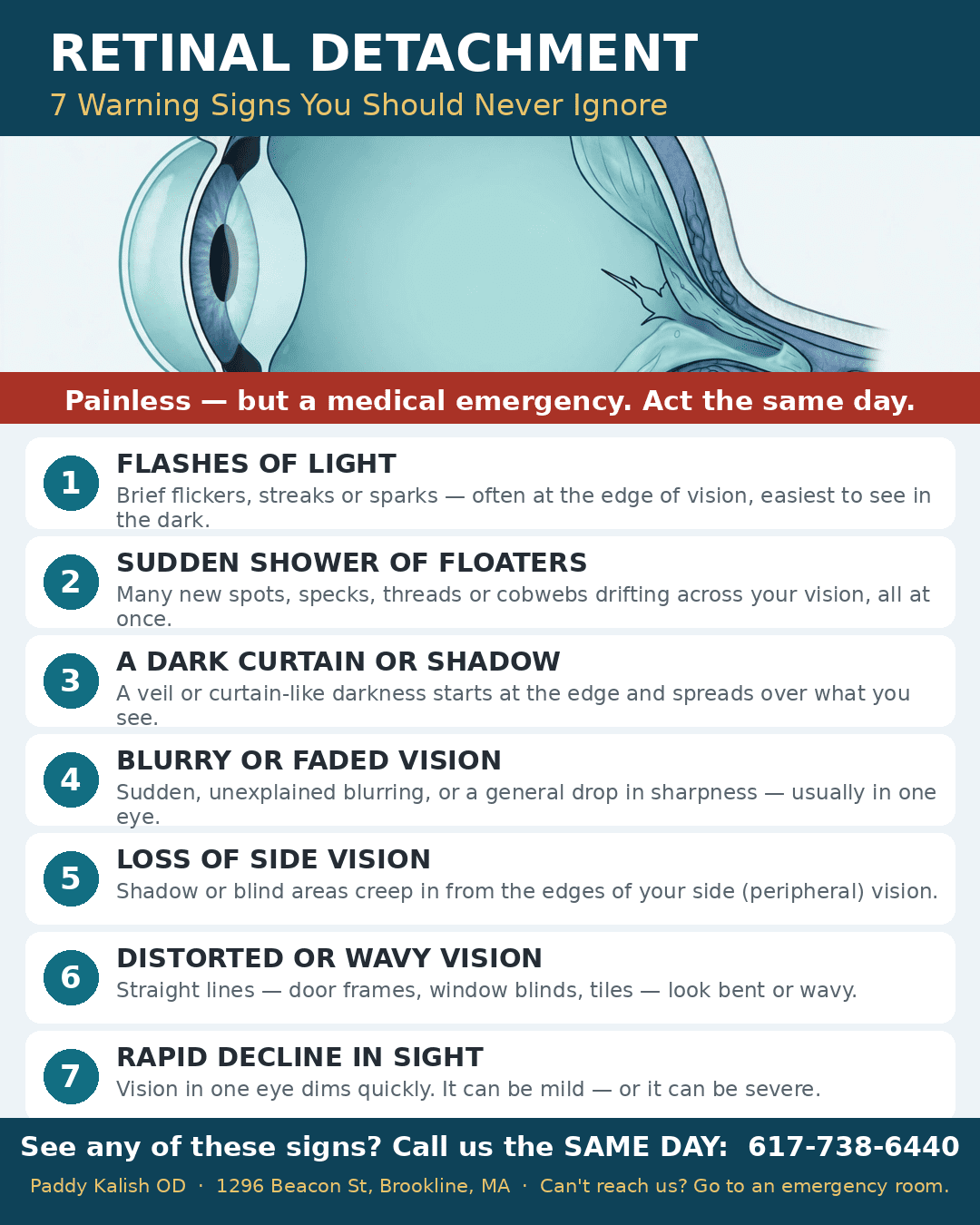 Retinal Detachment: 7 Signs