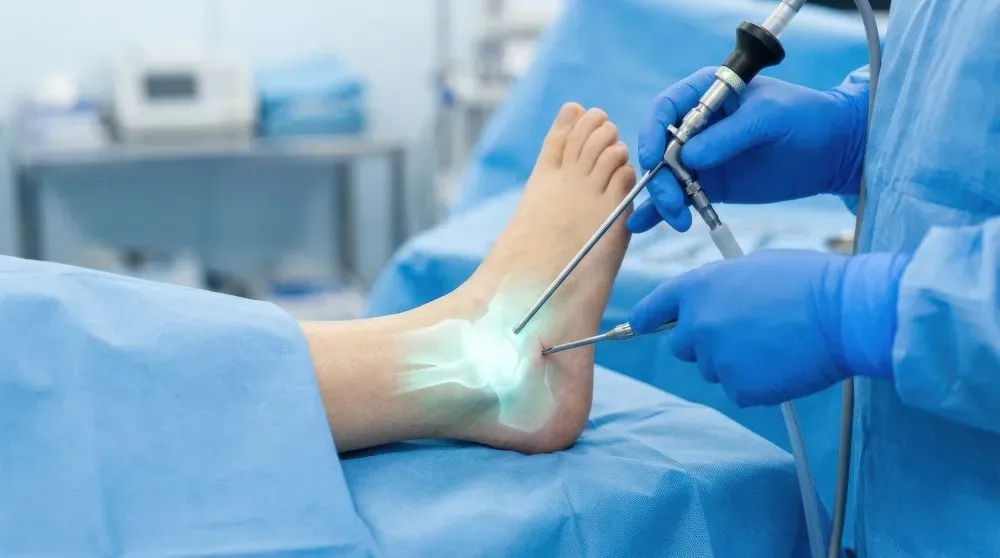 What To Expect After Ankle Arthroscopy
