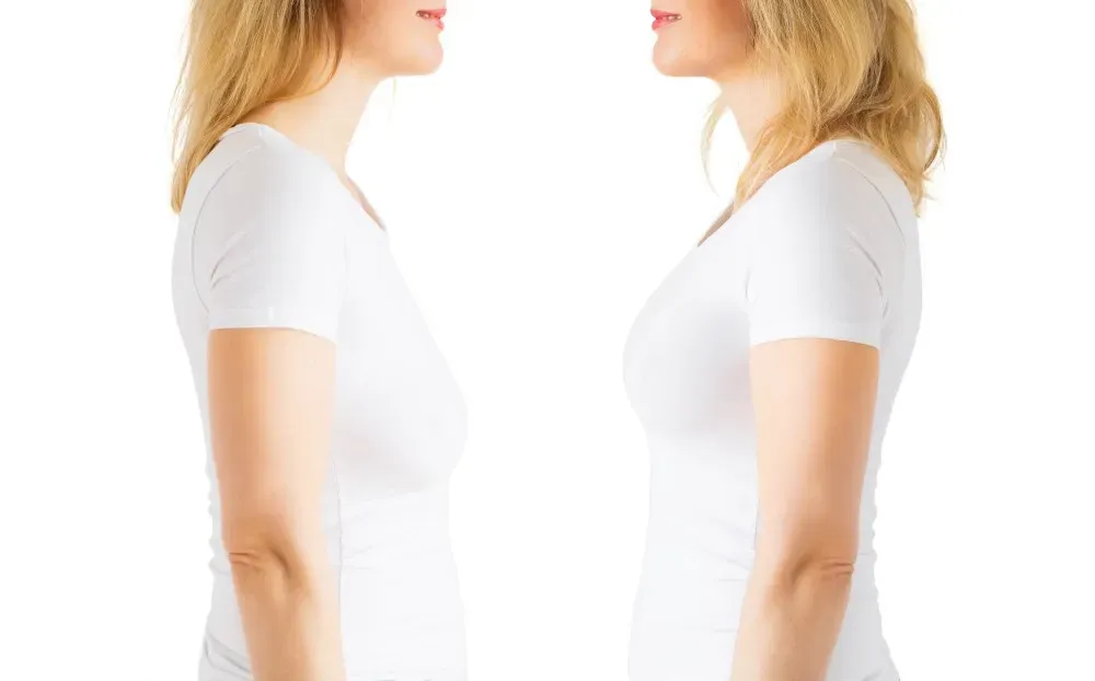 Breast Lift vs. Augmentation: How to Choose the Right Procedure for Your Silhouette