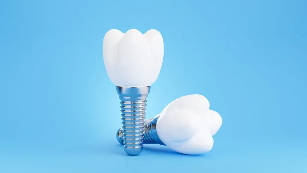 Why a High-Quality Implant Restoration Matters for Your Smile