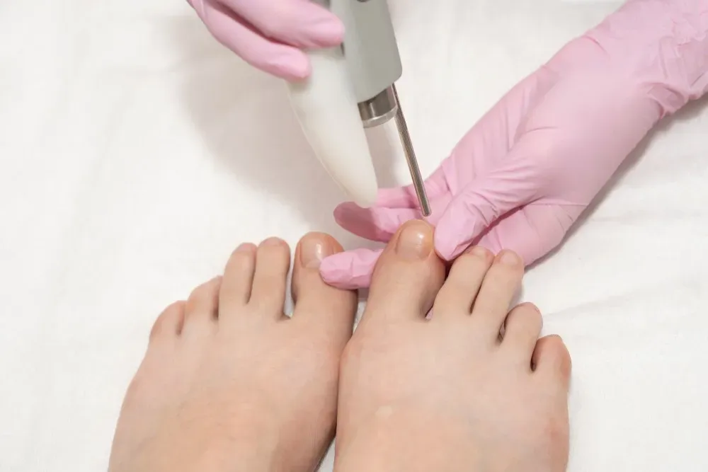 Advanced Laser Therapy: Your Dual Solution for Foot Pain and Nail Fungus