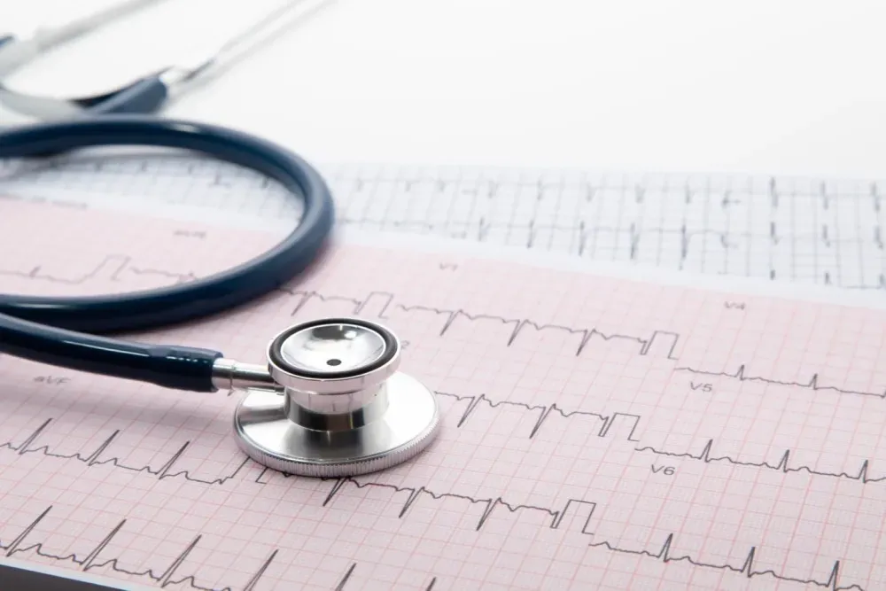 Everything You Need to Know About an EKG