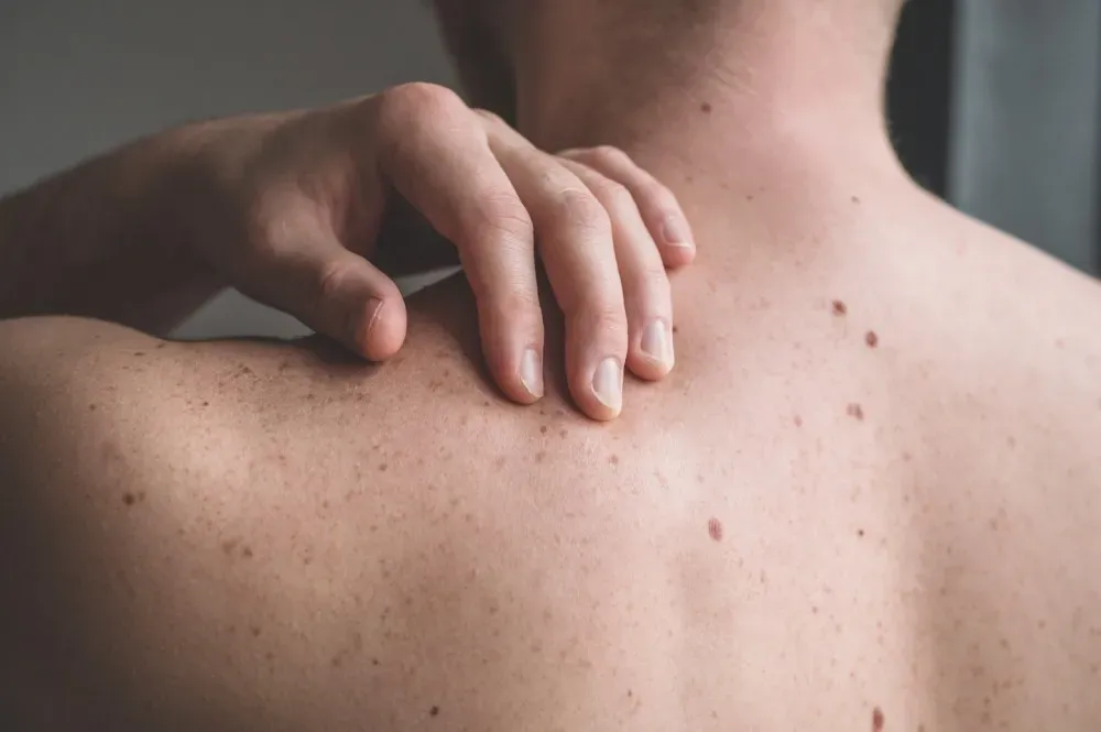 Why Winter Is the Ideal Time for Your Annual Skin Cancer Screening