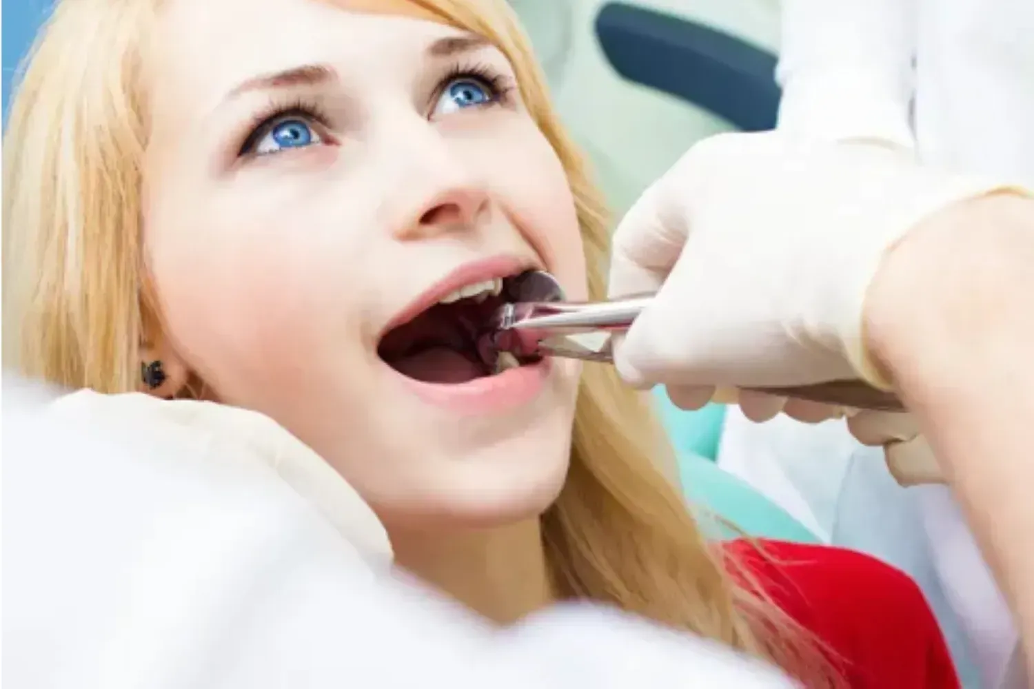 Root Canal Therapy in East Orange, NJ