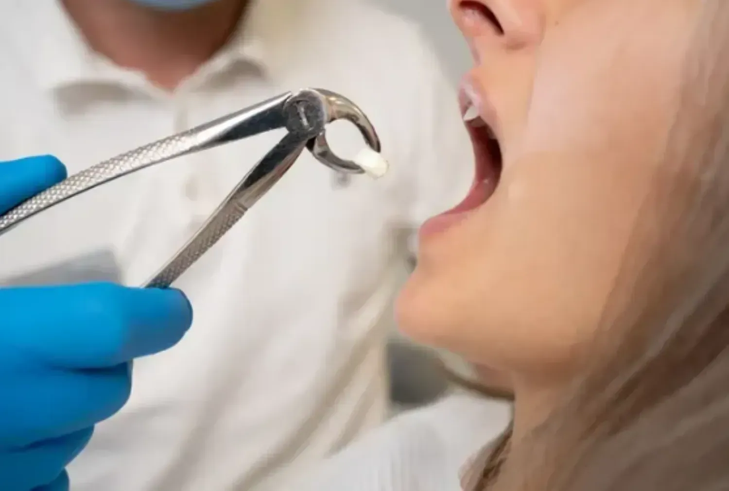 Tooth Extraction in East Orange, NJ