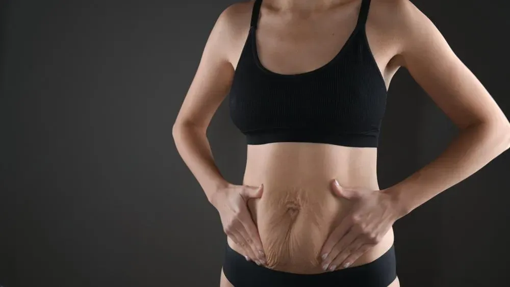 Loose Abdominal Skin