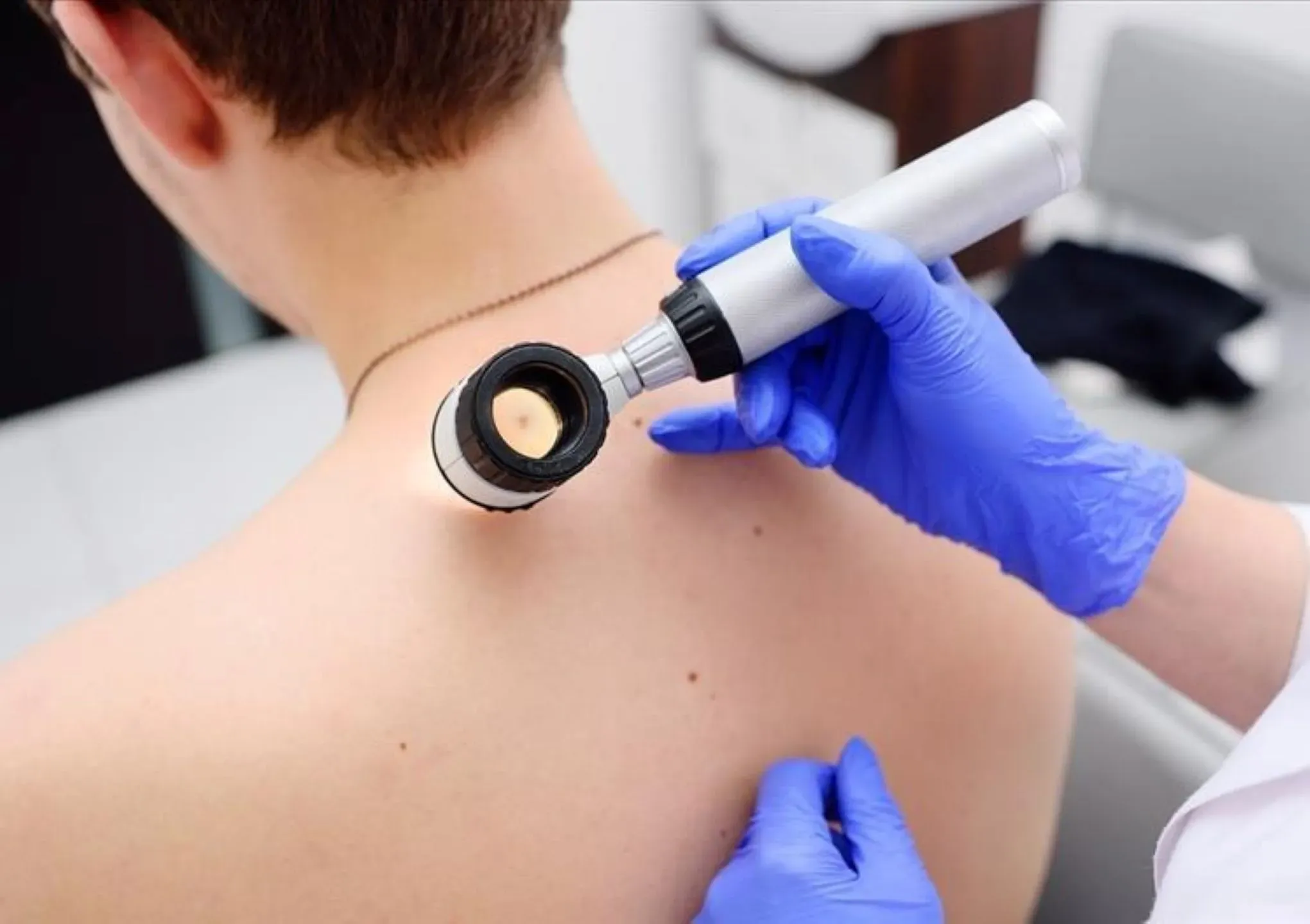 Skin Cancers