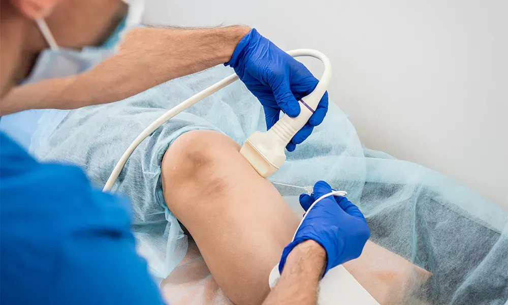 Radiofrequency Ablation (RFA)