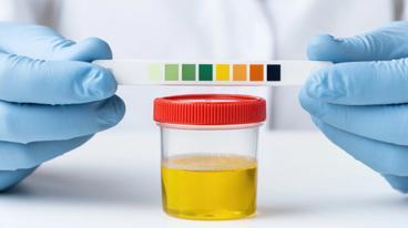 Uncovering Hidden Health Risks: A Functional Approach to Organic Acid Testing
